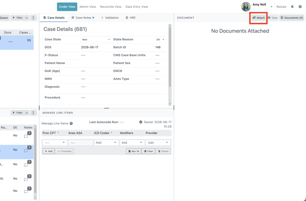 2) In the document pane click the 'Attach' button