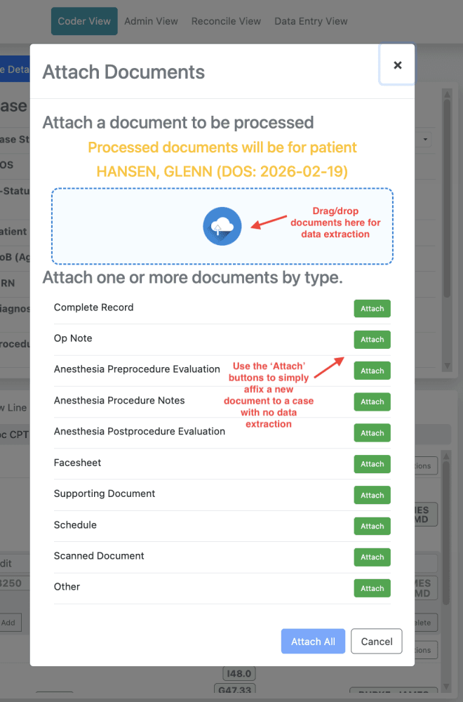 Don't need data extraction?