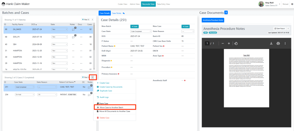 To move a Case to a different batch, select the case in the Cases Pane and click the 'Edit' button.